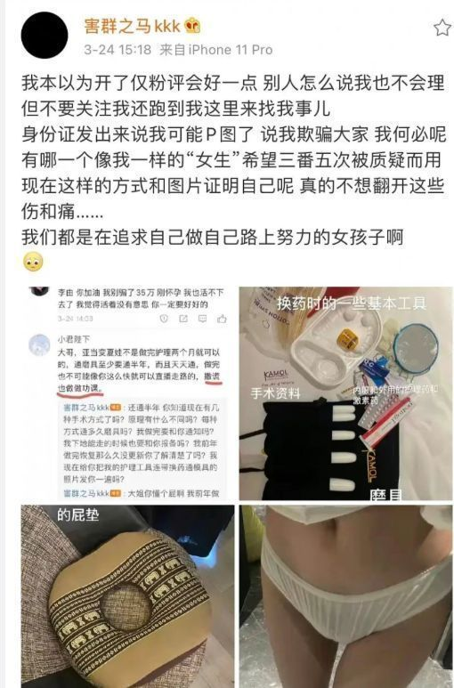 网红李由承认变性成功，自爆手术后痛了两个月，粉丝夸她像刘亦菲(图2)